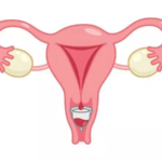 Cinco datos curiosos sobre las copas menstruales